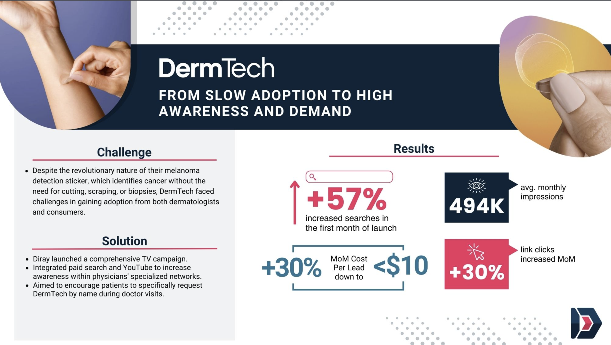 DermTech